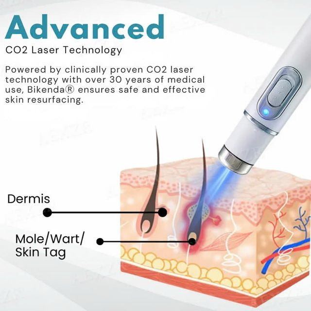 Non-Invasive Mole and Wart Removal Laser Pen