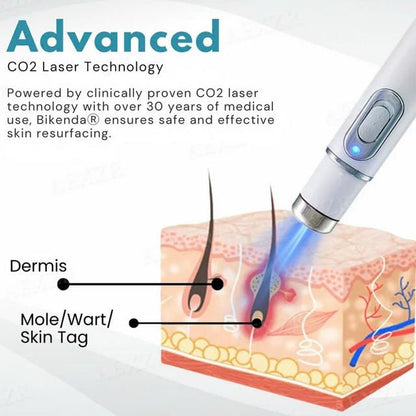 Non-Invasive Mole and Wart Removal Laser Pen